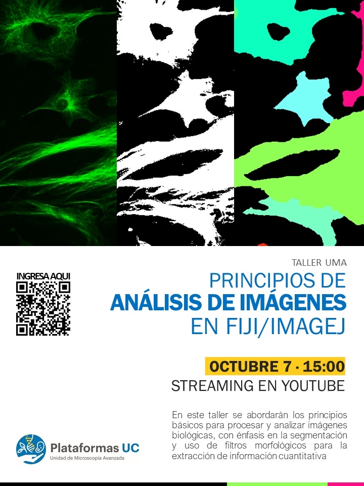 Taller UMA :: Principios de Análisis de Imágenes en FIJI/ImageJ